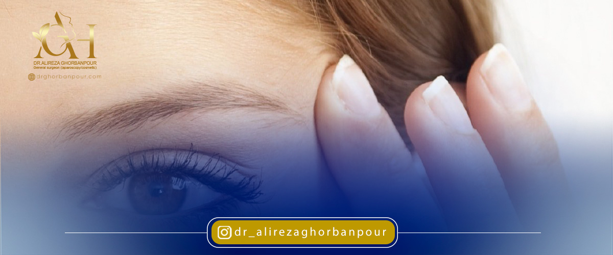 هزینه لیفت شقیقه