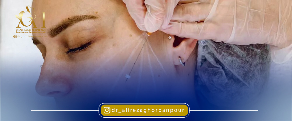 موارد منع جوانسازی با نخ