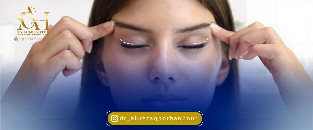 مراقبت های بعد از عمل جراحی لیفت شقیقه