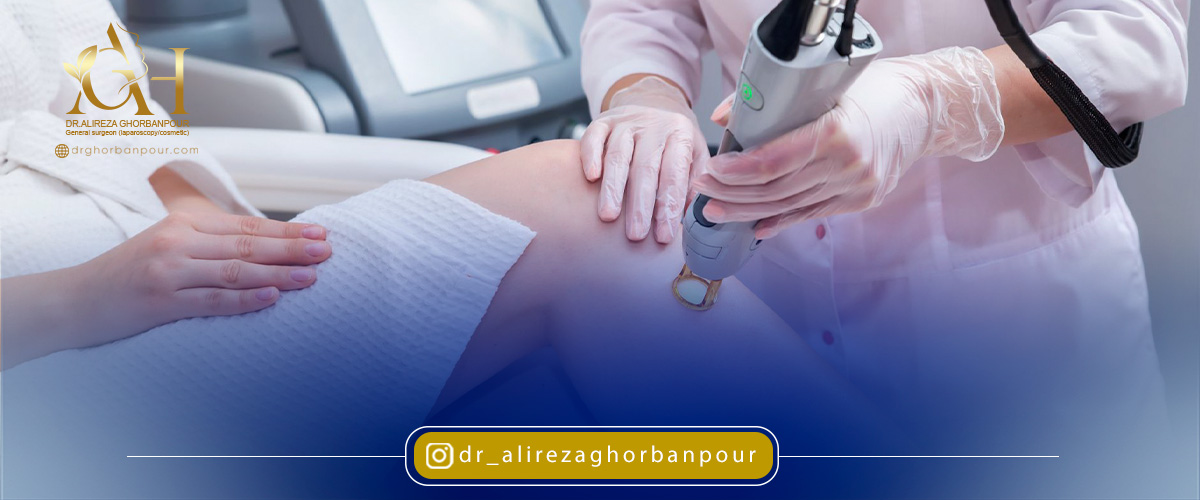 روند لیزر کردن چگونه است؟