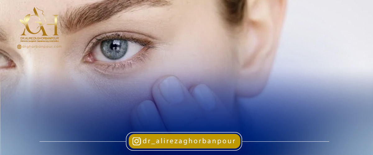 انواع لیفت شقیقه