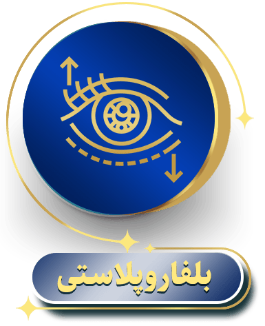 بلفاروپلاستی