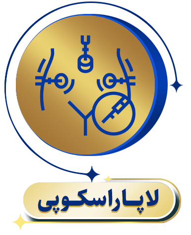 لاپاراسکوپی