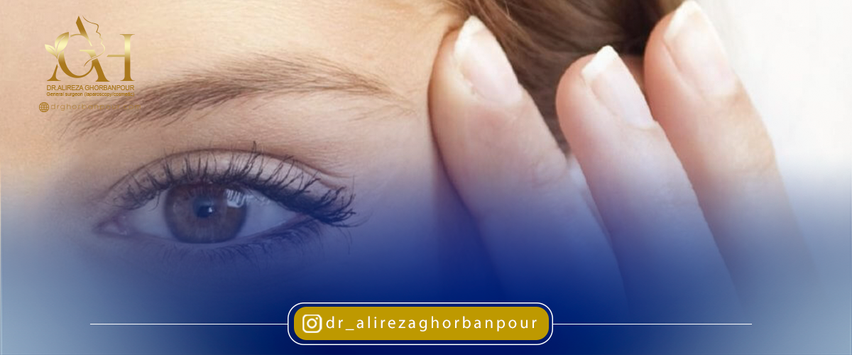 شقیقه کجاست؟