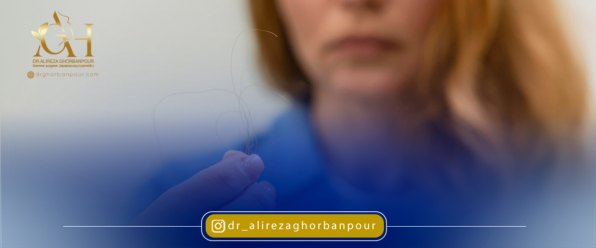 دلایل ریزش مو در زنان